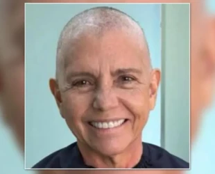 Roseana Sarney publica foto com os cabelos raspados: 'Pronta para mais uma etapa'