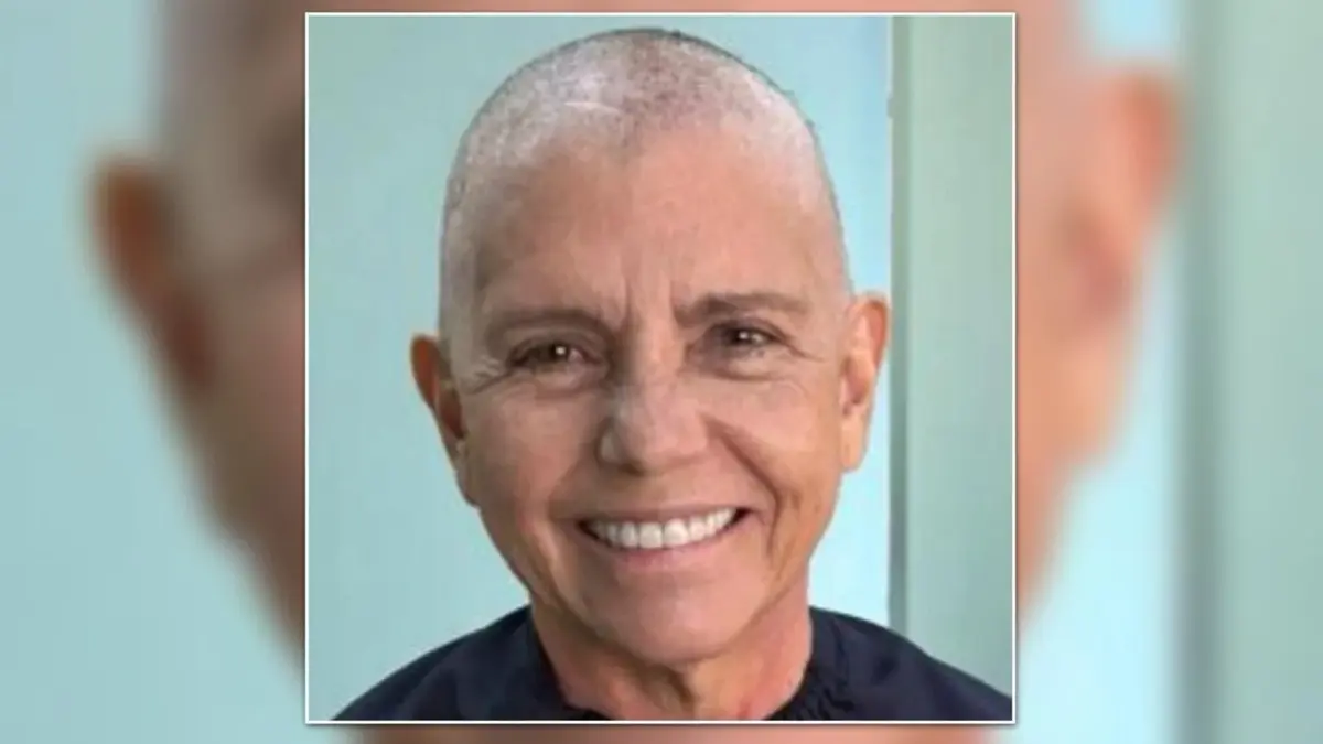 Roseana Sarney publica foto com os cabelos raspados: 'Pronta para mais uma etapa'