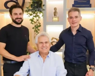 Caiado faz transplante capilar; confira