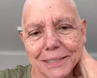 Diagnosticada com câncer aos 72 anos, Roseana Sarney diz não ter medo da morte