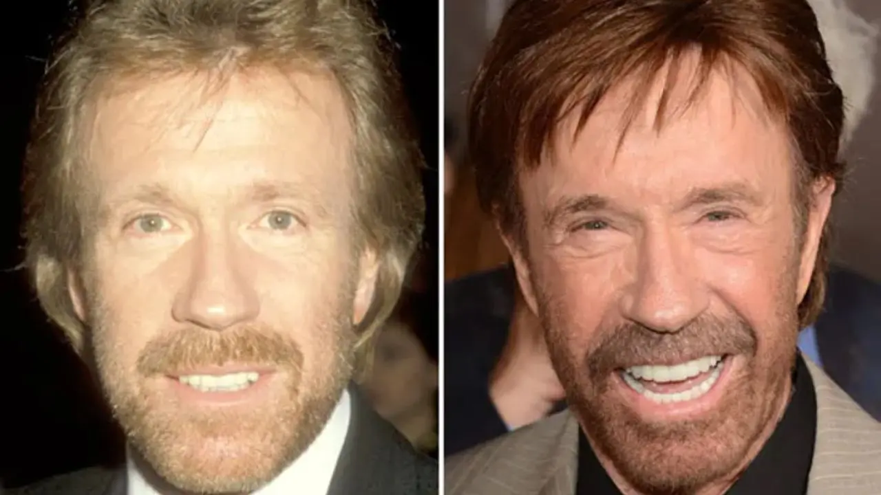 chuck-norris-before-and-after-plastic-surgery