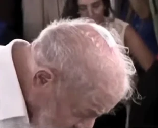 Lula mostra curativo no couro cabeludo resultado de retirada de câncer de pele