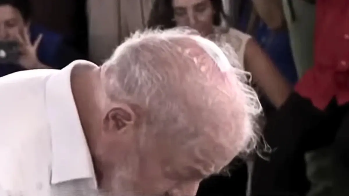 Lula mostra curativo no couro cabeludo resultado de retirada de câncer de pele